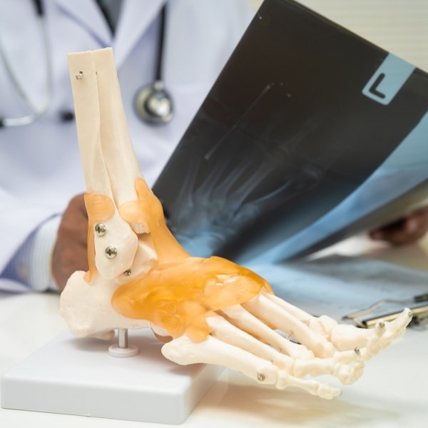 Cirugía Artroscópica de Tobillo en Santa Cruz